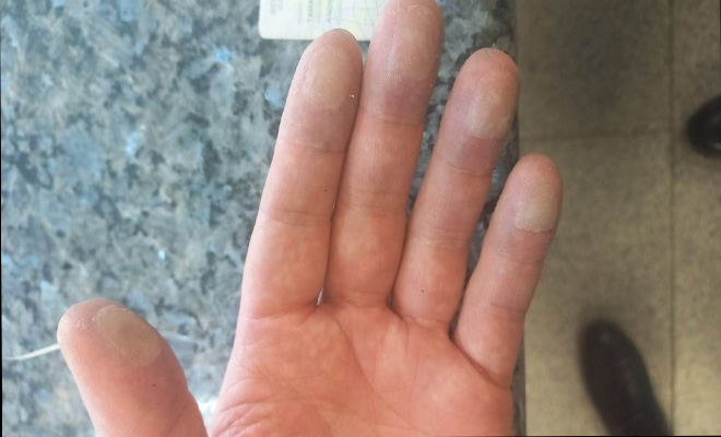 Capturado por usar huellas de látex  Capturado por usar huellas de látex