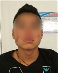 Capturan-a-dos-personas-cuando-llevaban-1.250-gramos-de-heroína-en-su-abdomen Capturan-a-dos-personas-cuando-llevaban-1.250-gramos-de-heroína-en-su-abdomen