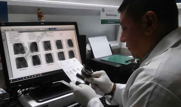 Prófugo de la justicia simuló estar muerto para tratar de burlar a las autoridades  pasto-captura-profugo-cirugias